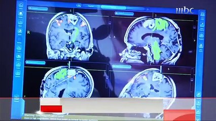 11  ألف إصابة  سنوية  بالسرطان في دول الخليج ..