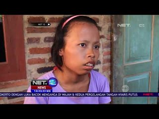 Ini, Windi, Gadis Difabel yang Ingin Jadi Desainer NET12