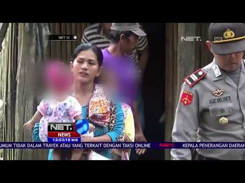 Tragis!! Bayi 5 Bulan Disiram Air Panas NET12