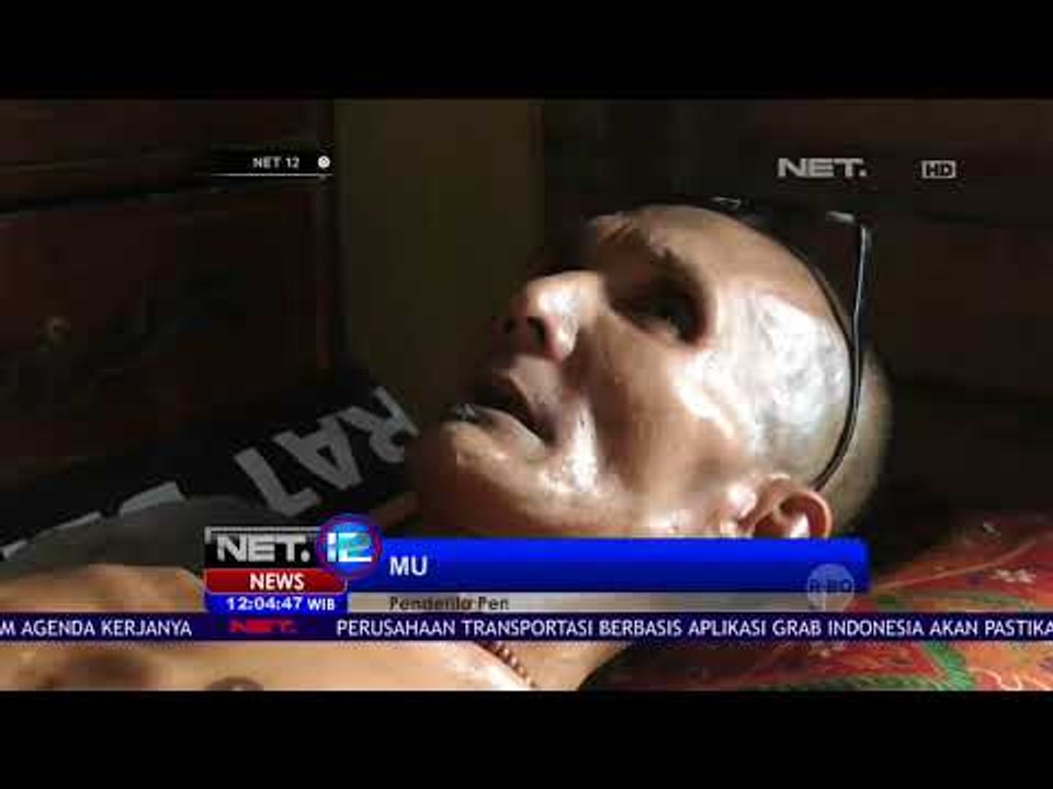 Mengeras Bagai Kayu, Begitulah Tubuh Munir yang Menderita Penyakit Langka NET12