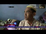 Jemadi, 4 Tahun Menderita Kanker Kulit - NET 12
