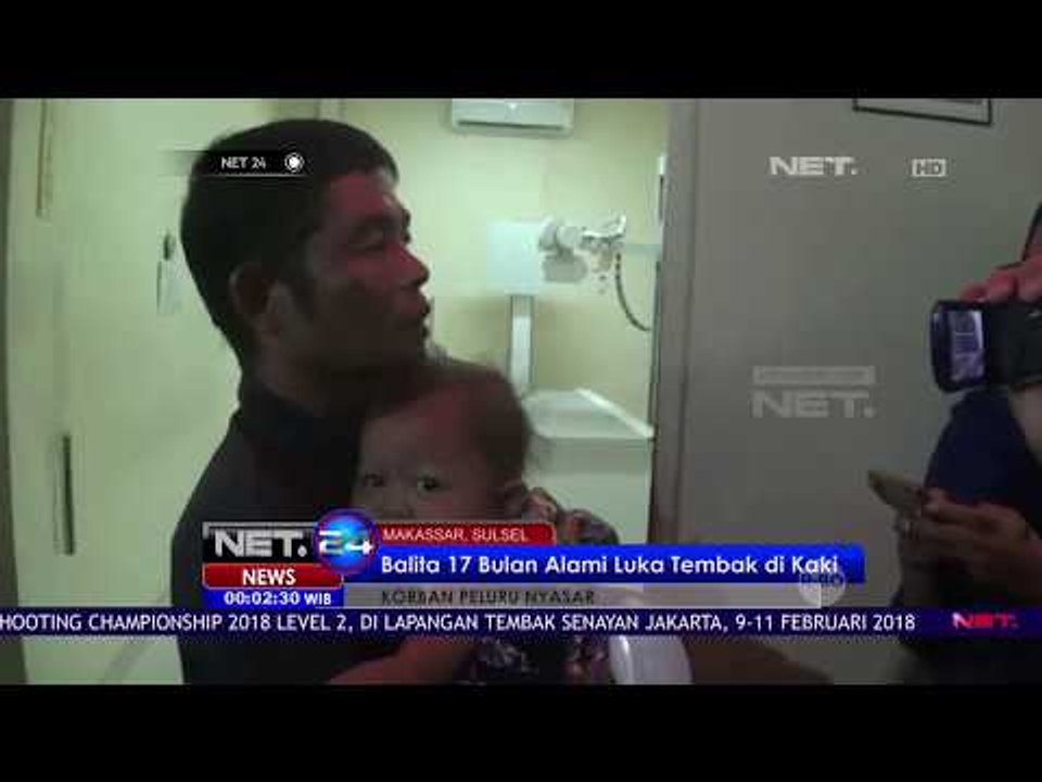 Balita 17 Bulan Alami Luka Tembak Di Kaki - NET 24