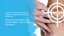 CoolMini™ – CoolSculpting® for Double Chins - CoolSculpting Toronto Clinic