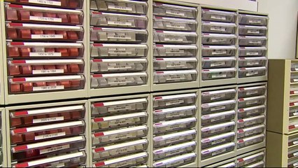 Researchers Discover Melanoma Can Recur Decades Later