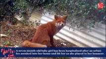 Urban Fox Attacks and Bites 7-Month-Old Girl