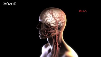 Kadir İnanır'a yapılan işlemin animasyonu