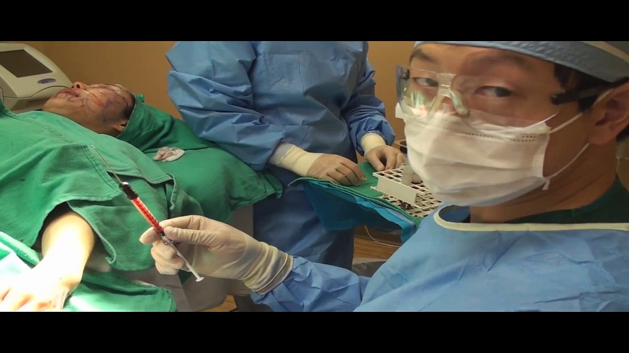 Fat injections of the Hand Live Video of Plastic Surgery by Dr Young of Seattle, Bellevue Washington