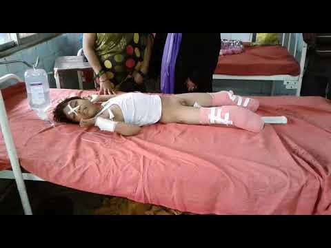 Child legs Cut down with engine while crossing the railway track