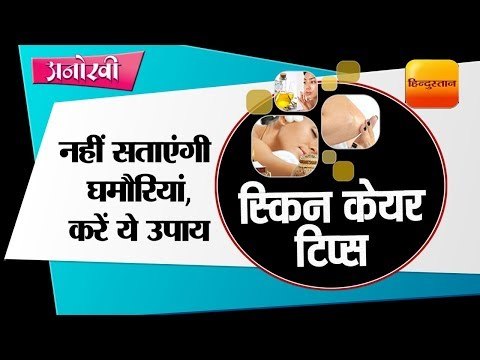 How to cure prickly heat by dr deepali bhardwaj II नहीं सताएंगी घमौरियां, करें ये उपाय
