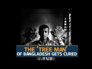 Bangladesh 'Tree Man' gets to go home after recovery from surgery