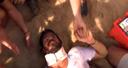 Survivor'da Korkutan Kaza! Ünlüler Takımından Hakan Görme Sorunu Yaşayabilir