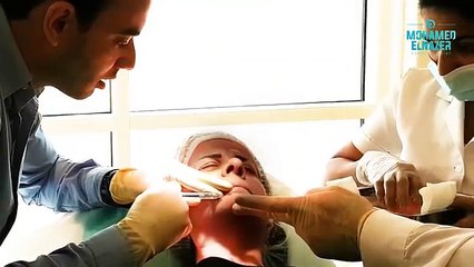 استخدام الفيلر لجعل الوجه يبدو أنحف وأكثر نضارة