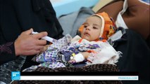 الكوليرا وسوء التغذية يفتكان بأطفال اليمن