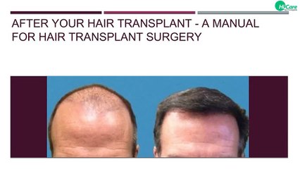 After your Hair Transplant - A Manual for Hair Transplant surgery