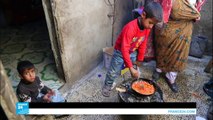 موت طفل يمني كل عشر دقائق بسبب سوء التغذية وانتشار الأمراض
