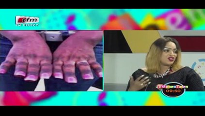 RUBRIQUE BIEN ETRE avec MADO dans Yeewu Leen du 19 Février 2018