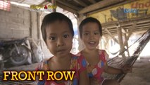 Front Row: Conjoined twins sa Pangasinan, napaghiwalay na