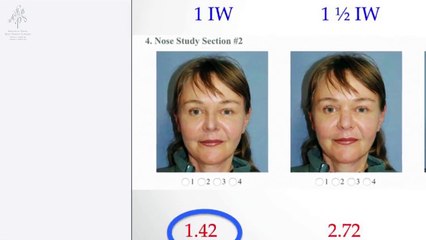 Rhinoplasty Introduction by Dr Philip Young of Bellevue, Seattle Washington