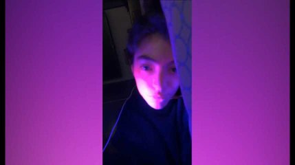 Lorde apporte son soutien à tous ceux qui ont de l'acné