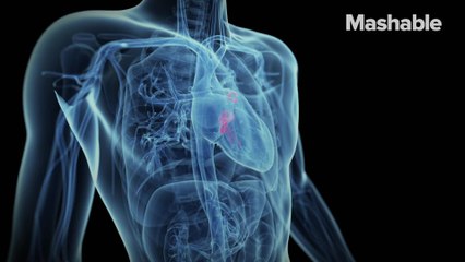 Google is learning how to predict heart disease by looking at your eyes