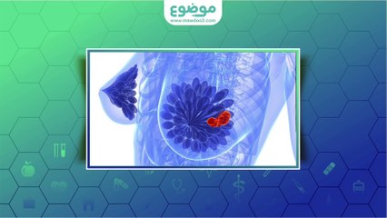 ما سبب الوخز في الثدي