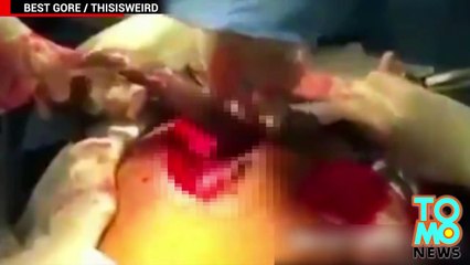 Etrange fétichisme, un homme se fait enlever un poisson de son derriere