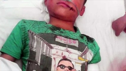 Une belle-mère abuse son beau-fils âgé de 6 ans et le laisse pour à moitié mort