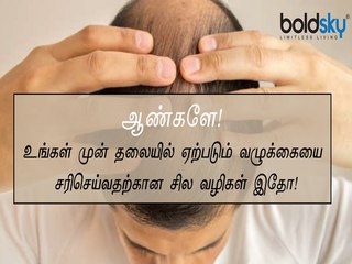 ஆண்களே! உங்கள் முன் தலையில் ஏற்படும் வழுக்கையை சரிசெய்வதற்கான சில வழிகள் இதோ! | Boldsky