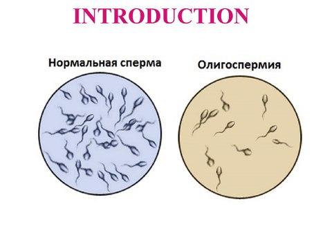 Male infertility: Common causes and treatments