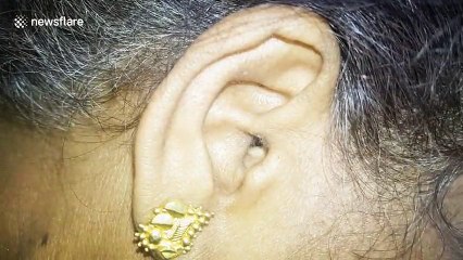 Une araignée dans l'oreille