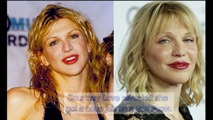 Stars Who Have Openly Admitted to Having Plastic Surgery- Before & After Pics