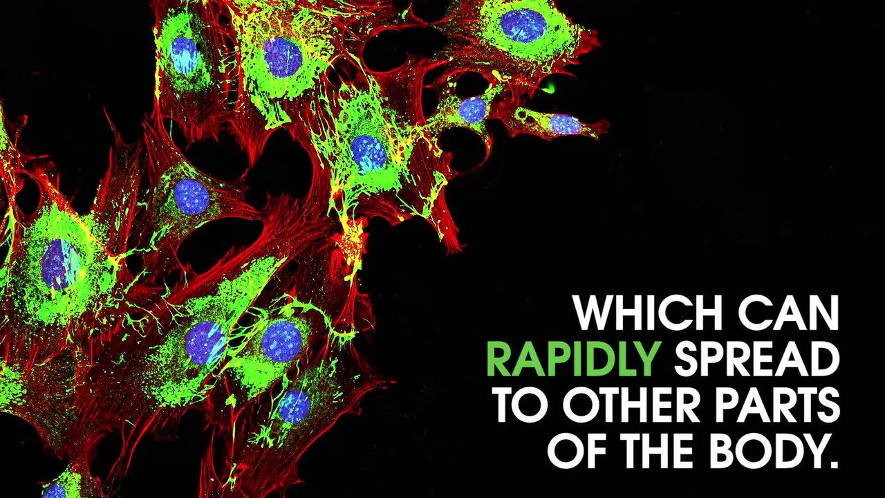What Is Cancer?