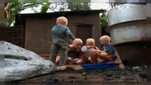 Albinos vítimas de perseguição em Moçambique