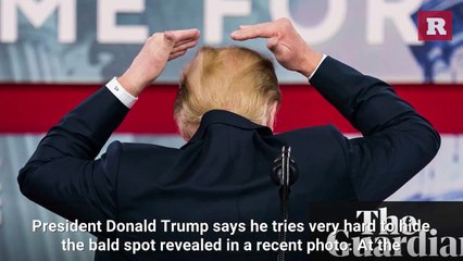 Trump admits he tries very hard to hide his bald spot | Rare Media