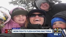 Valley mom fighting flesh-eating bacteria speaks about her battle