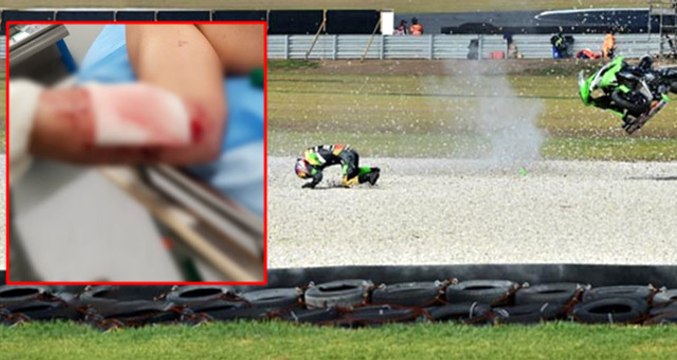 Milli Motosikletçi Kenan Sofuoğlu, 257 KM Hızla Giderken Kaza Yaptı