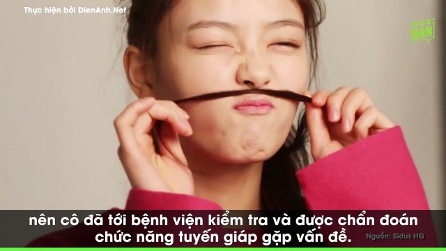 Vừa nhận phim mới chưa kịp quay, Kim Yoo Jung đột ngột ngã bệnh đến nỗi phải tạm nghỉ để dưỡng bệnh?