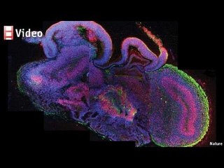Growing human brain tissue: The organoid without a face