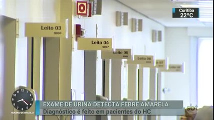 Exame de urina que detecta o vírus da febre amarela já é usado em SP