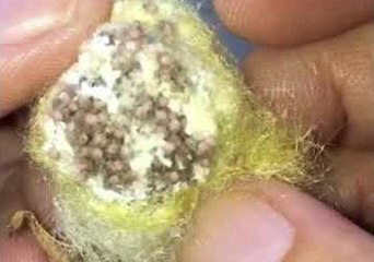 Nephila Edulis Babies Moving in Their Egg Sac