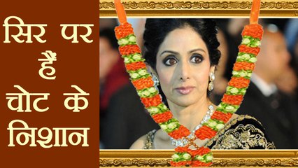 Sridevi की Post-mortem Report में सिर पर गहरी चोट की बात आई सामने | वनइंडिया हिंदी