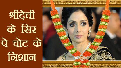 Sridevi के सिर पर गहरी चोट के निशान की बात आई सामने | Boldsky