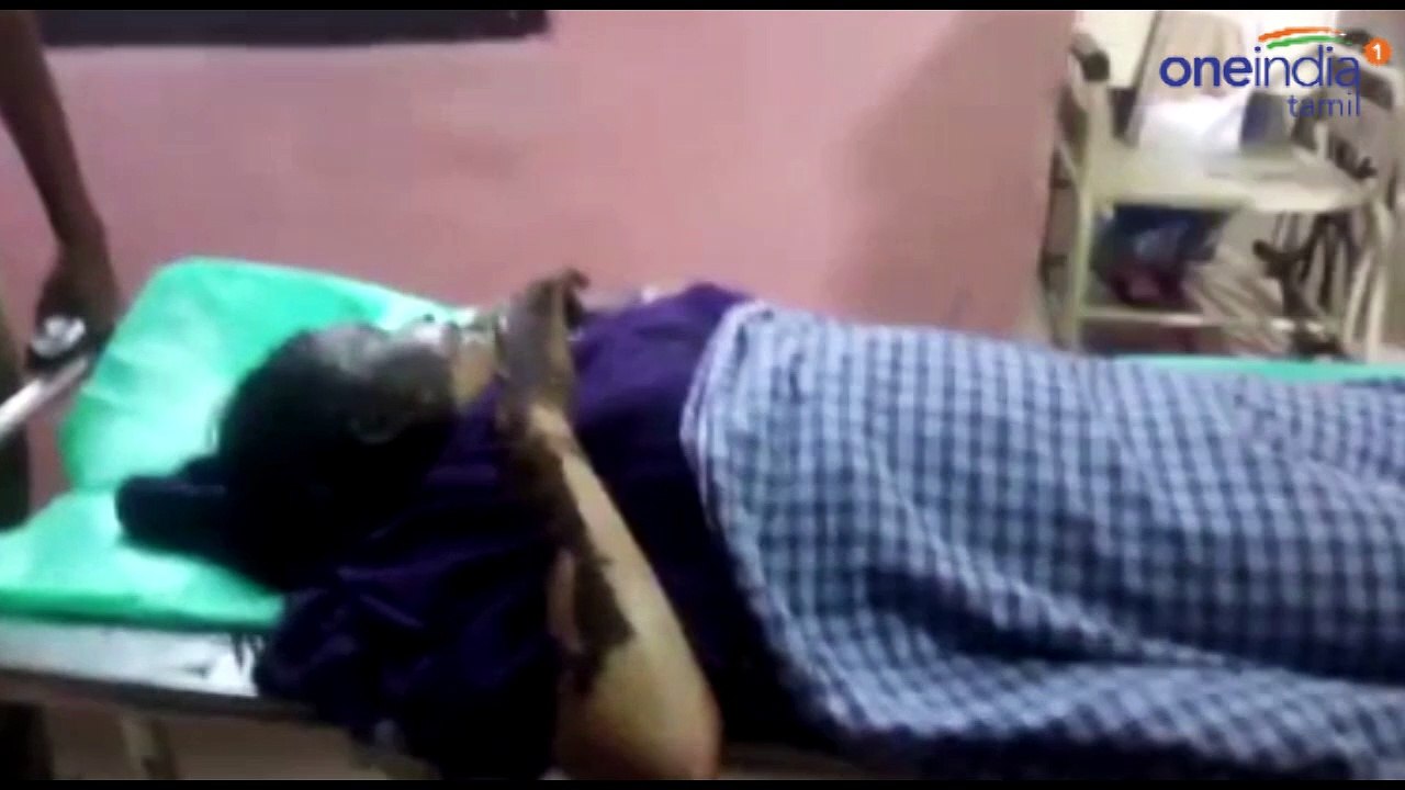 பெட்ரோல் ஊற்றி எரிக்கப்பட்ட 9ம் வகுப்பு மாணவி பலி !- வீடியோ