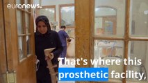 Iraq prosthetic centre attempts to help Mosul casualties