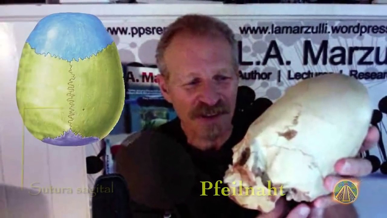 Die DNA der Paracas-SCHÄDEL Enthüllt Etwas Unerwartetes