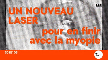 Un nouveau laser pour lutter contre la myopie