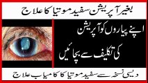 safed motia ka ilaj in urdu | Bagair Operation Motiya (Cataract) ka ilaj - Safed Motia Ka ilaj