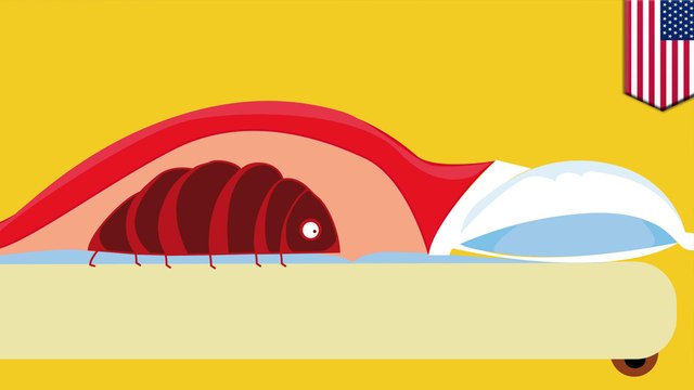 U.S. cities exploding with solid bed bug numbers