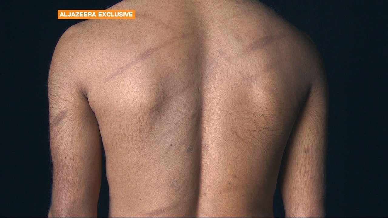 Evidence of ongoing torture of Sri Lankan Tamils