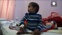 Yemen: UNICEF raises alarm about child malnutrition in 'the forgotten war'